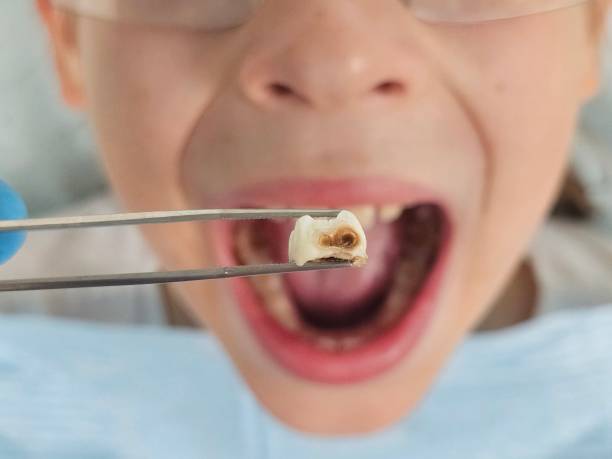 Best Broken Tooth Emergency  in North Muskegon, MI