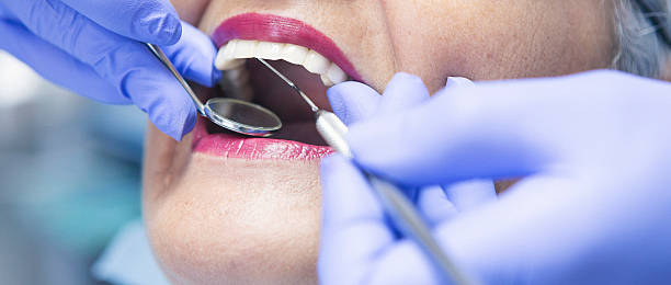 Best Teeth Whitening  in North Muskegon, MI